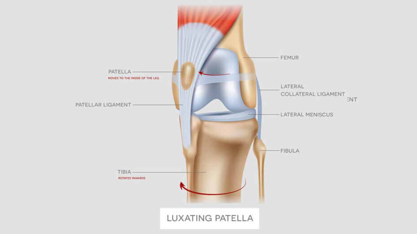Immagine anatomica di un ginocchio laterale